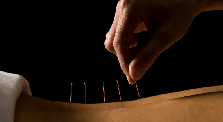 acupuncture-Lissner-medecine-chinoise-Strasbourg